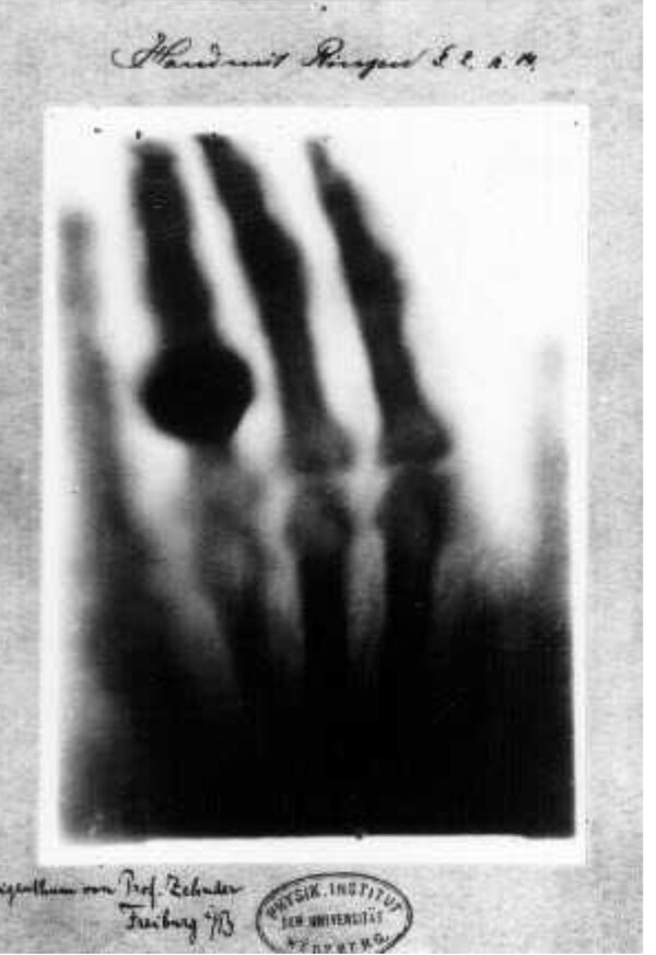 [사진=독자제공] 뢴트겐이 자신의 아내의 손을 세계 최초로 X레이 장치로 찍은 사진